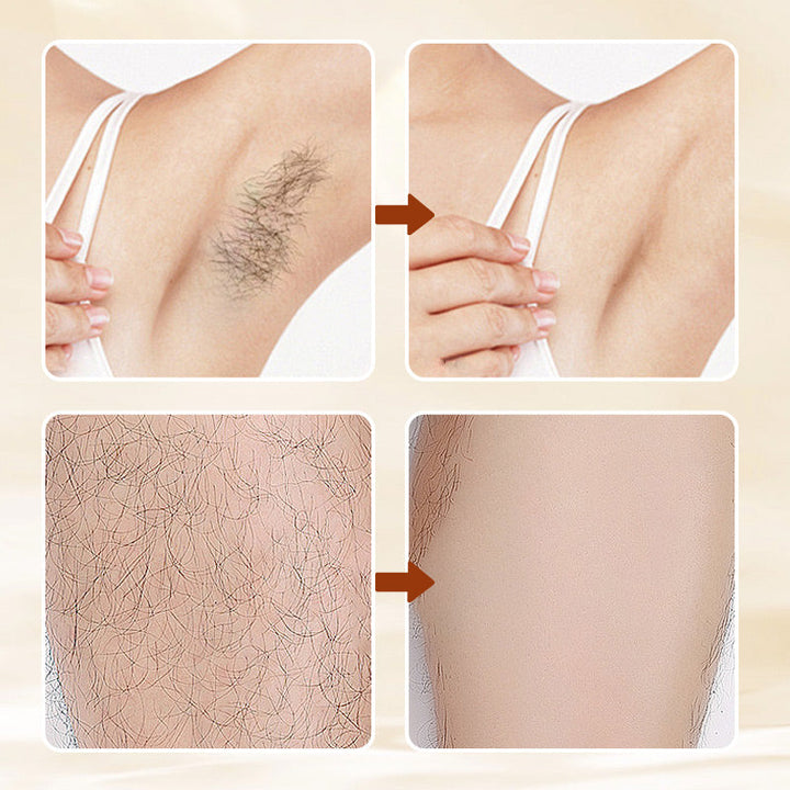 Hair Removal Cream for Women | 100 ml, Sensitive Skin Formula | Smooth, Irritation-Free Results in Minutes, No Shaving 3