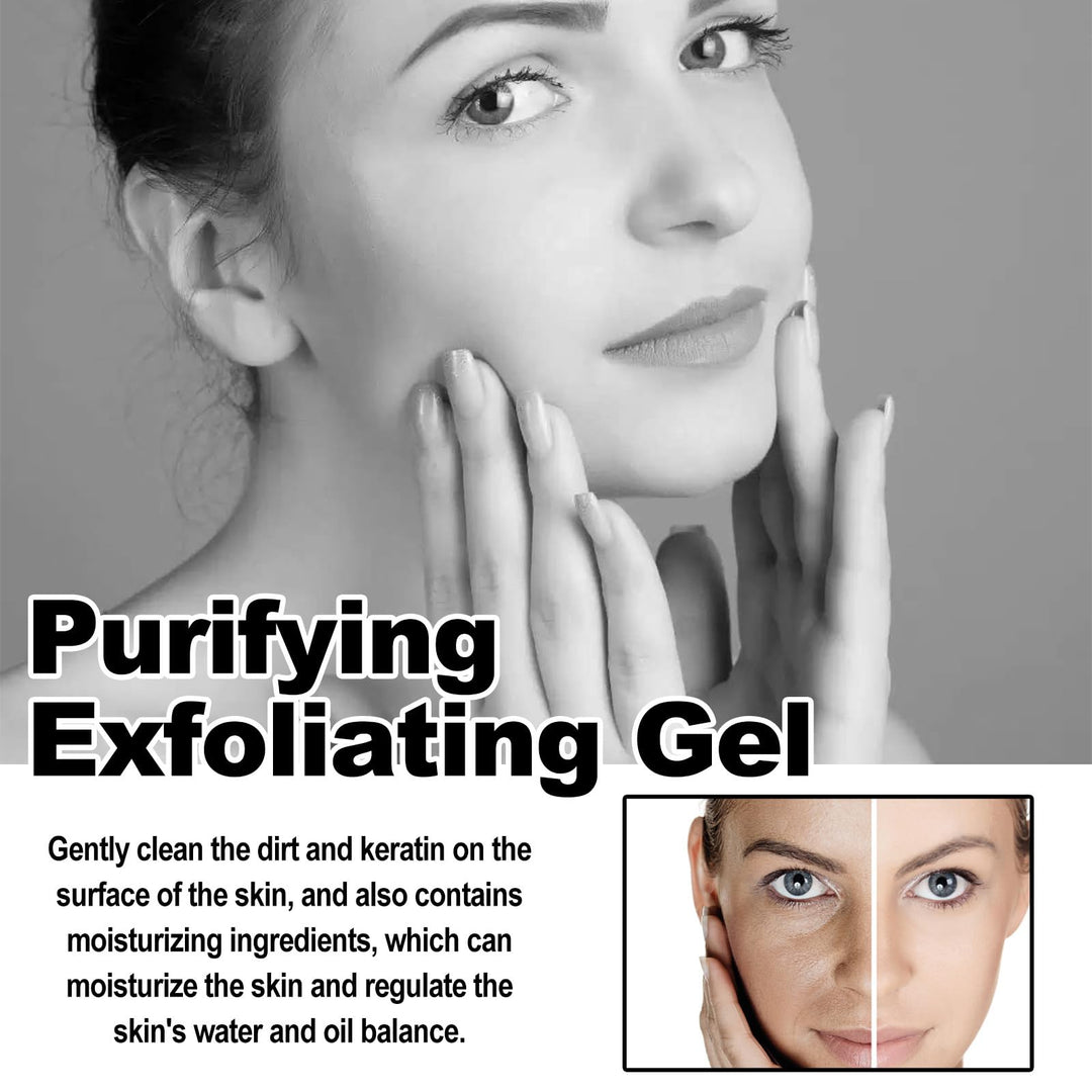 Exfoliating Gel for Women | Vitamin C, Sodium Hyaluronate &amp; Cherry Blossom | Smooths Rough Skin, Fades Dark Patches in 1 Minute 3