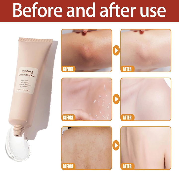 Exfoliating Gel for Women | Vitamin C, Sodium Hyaluronate &amp; Cherry Blossom | Smooths Rough Skin, Fades Dark Patches in 1 Minute 5