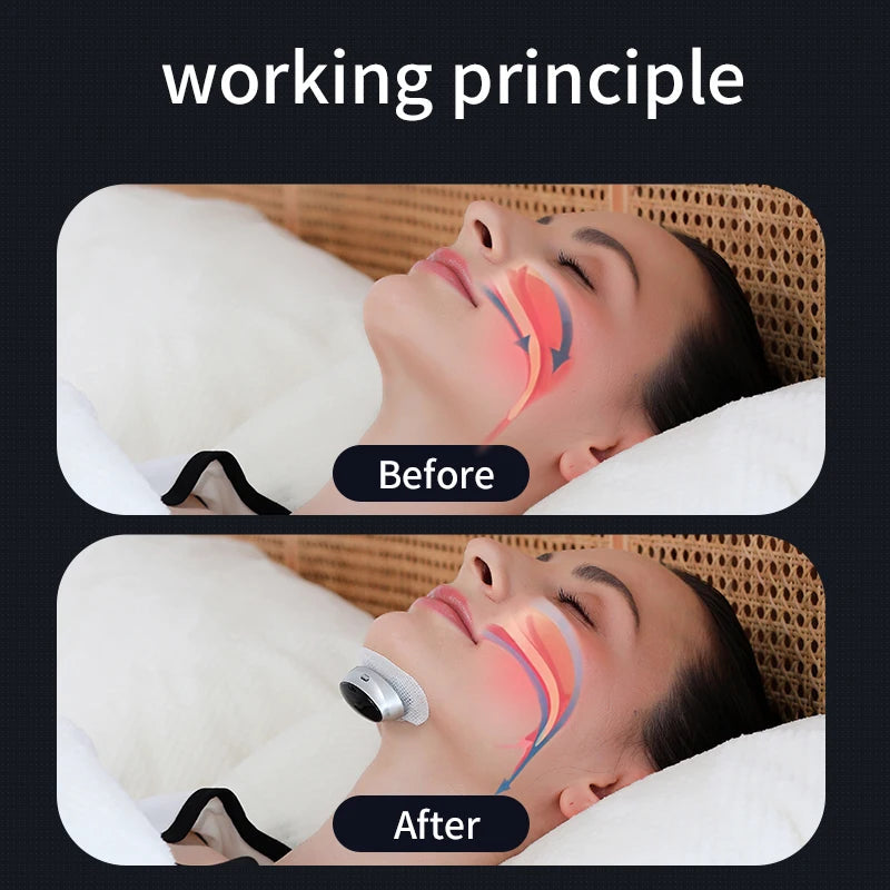 Anti Snoring Device | ZHQ-017 Smart Laryngeal Massager