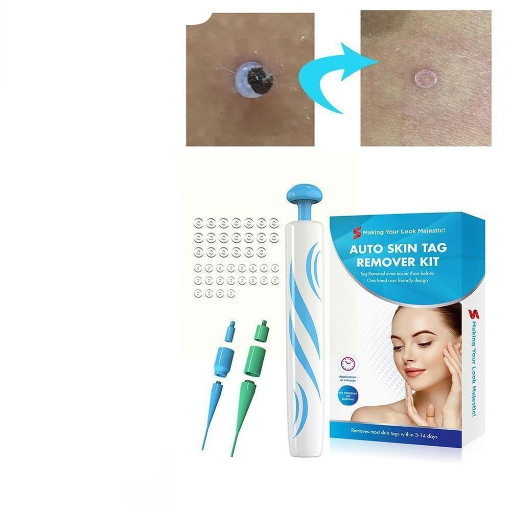 Auto Skin Tag Remover Painless 1