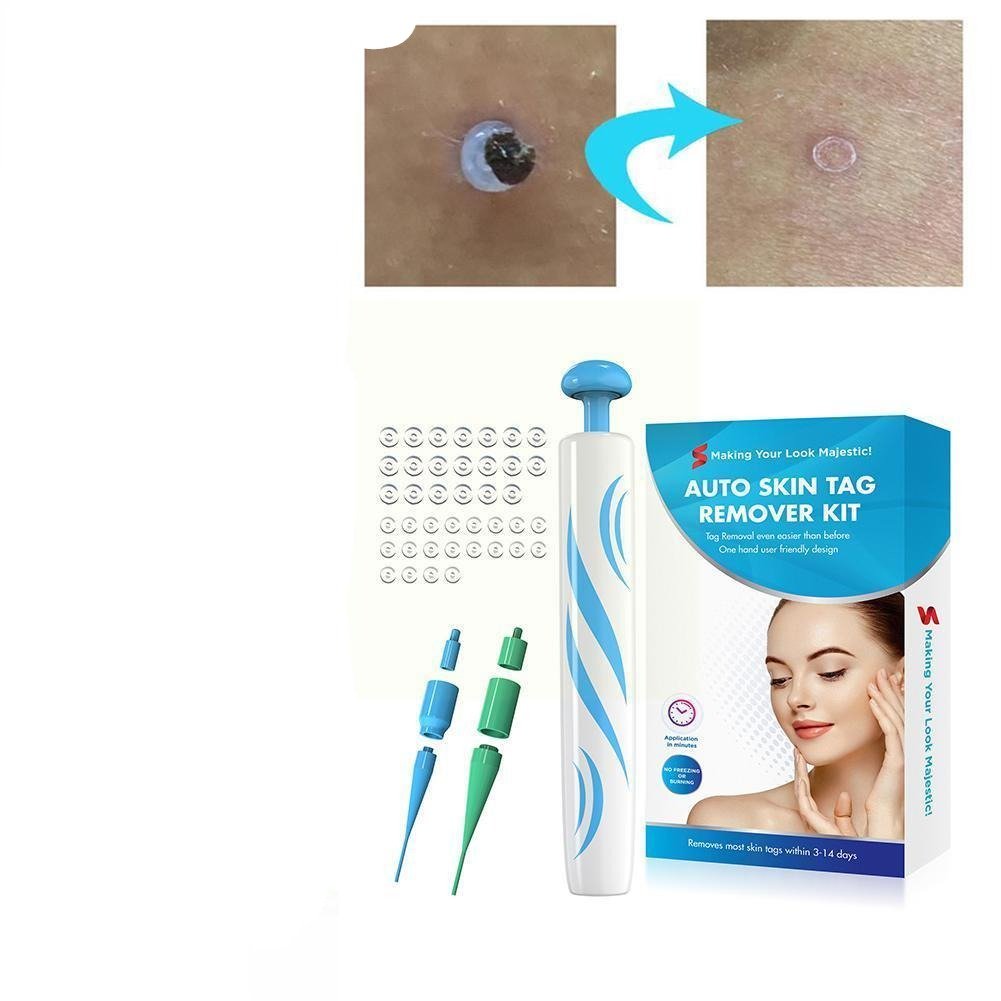 Auto Skin Tag Remover Painless 1