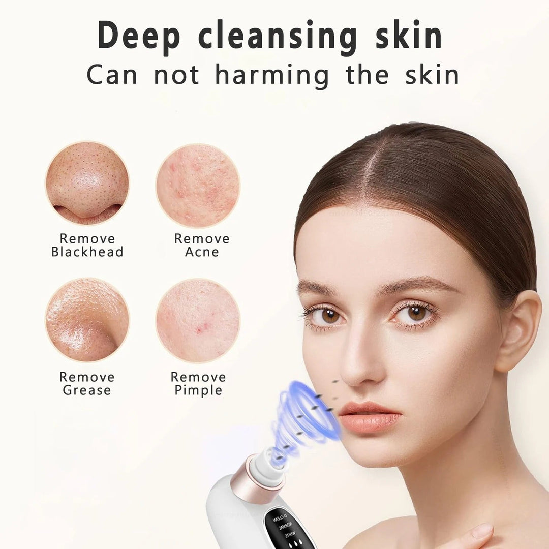 Blackhead Remover Vacuum Tool | Negative Pressure, 6 Interchangeable Heads | Dual Tank Pore Cleanser with LED Display