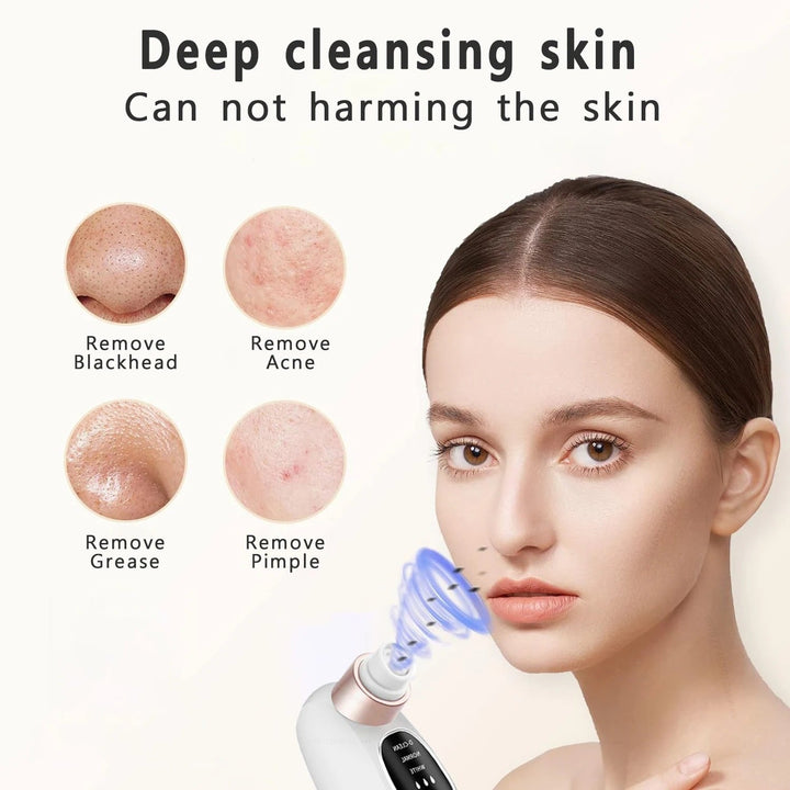 Blackhead Remover Vacuum Tool | Negative Pressure, 6 Interchangeable Heads | Dual Tank Pore Cleanser with LED Display