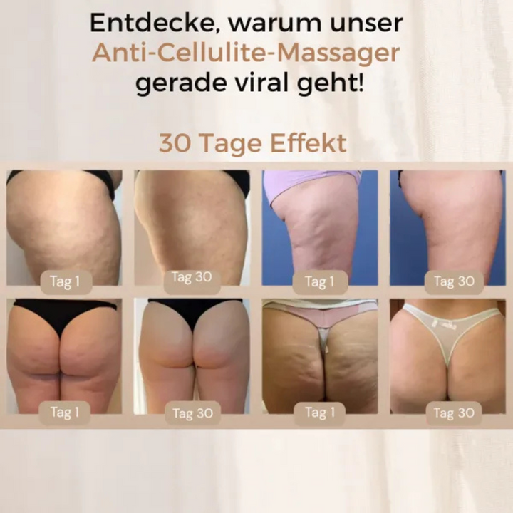 Body Massage Device | Gentle Vibration Massage for Firmer, Smoother-Looking Skin | Compact, Cordless &amp; Easy to Clean