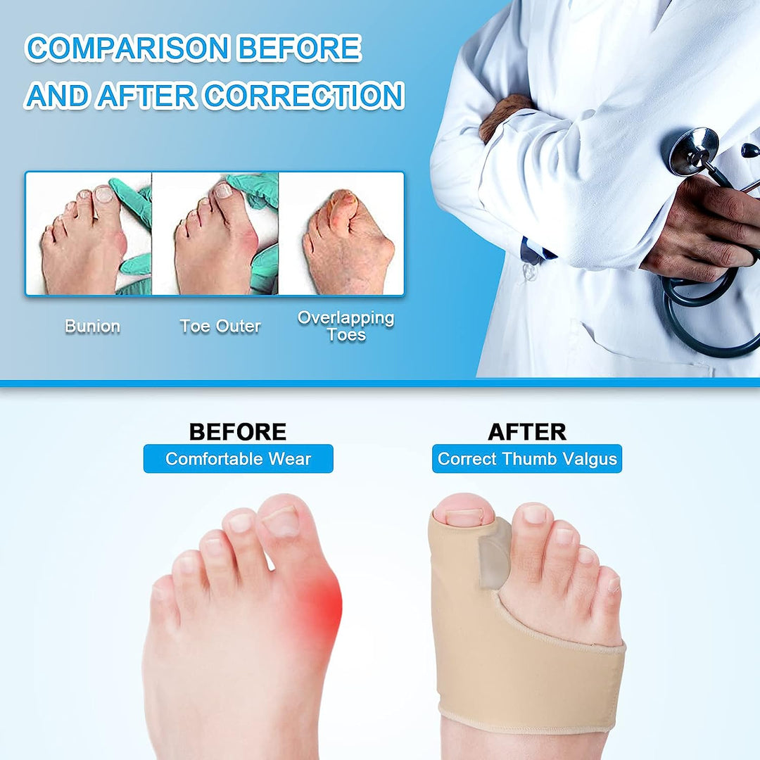 Bunion Corrector Sleeve | Silicone Gel Toe Spacer &amp; Cushioned Pad | Pair for All-Day Bunion and Hallux Valgus Relief