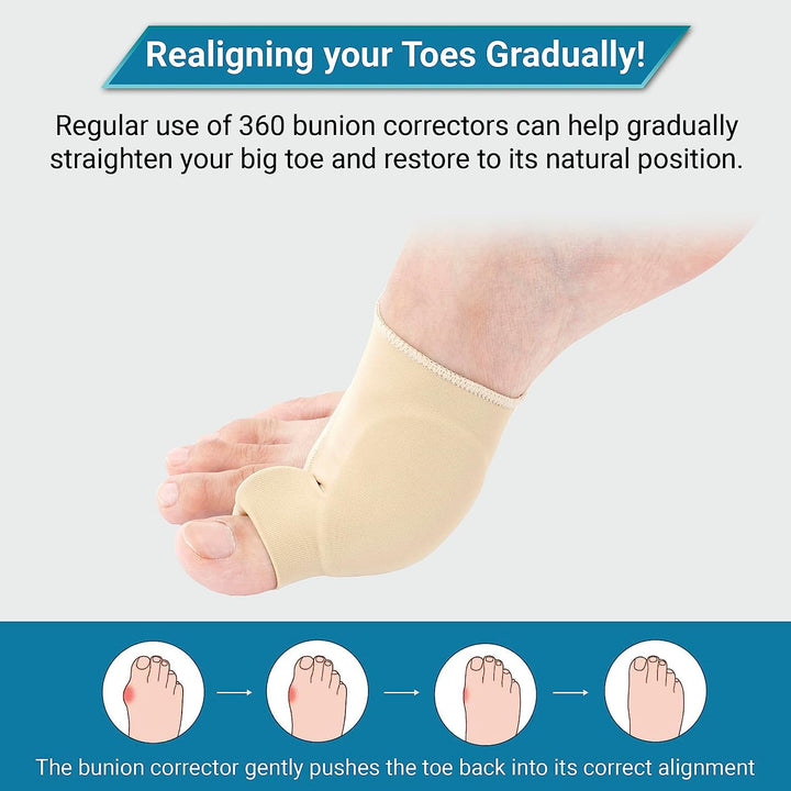 Bunion Corrector Sleeve | Silicone Gel Toe Spacer &amp; Cushioned Pad | Pair for All-Day Bunion and Hallux Valgus Relief