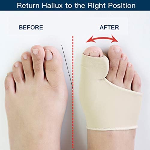 Bunion Corrector Sleeve | Silicone Gel Toe Spacer &amp; Cushioned Pad | Pair for All-Day Bunion and Hallux Valgus Relief