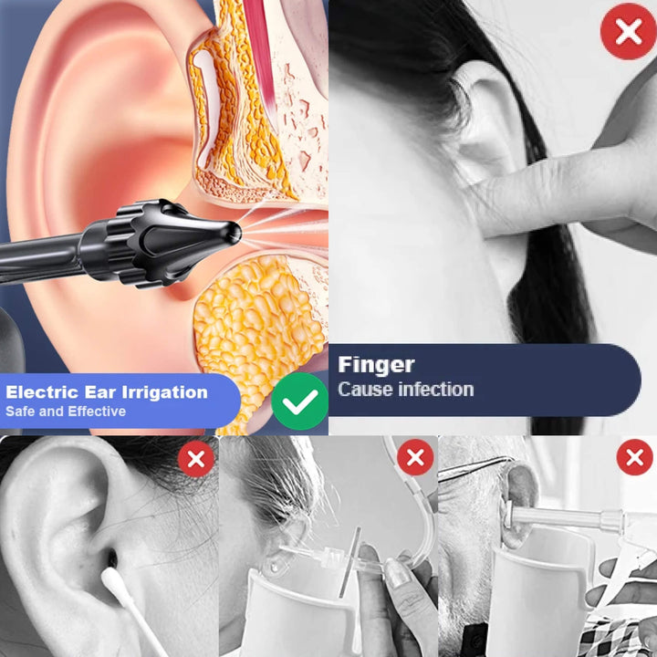 Ear Cleaner | Water Jet With Adjustable Pressure Settings