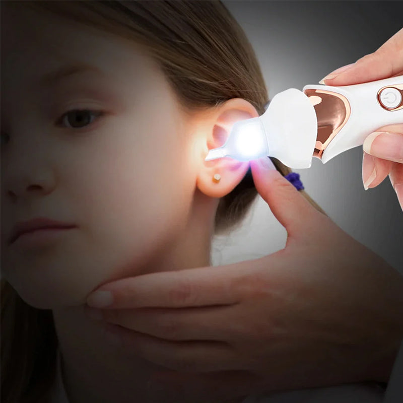 Electric Earwax Remover Tool | 5 Interchangeable Silicone Tips | USB Rechargeable, Gentle Noiseless Ear Cleaning