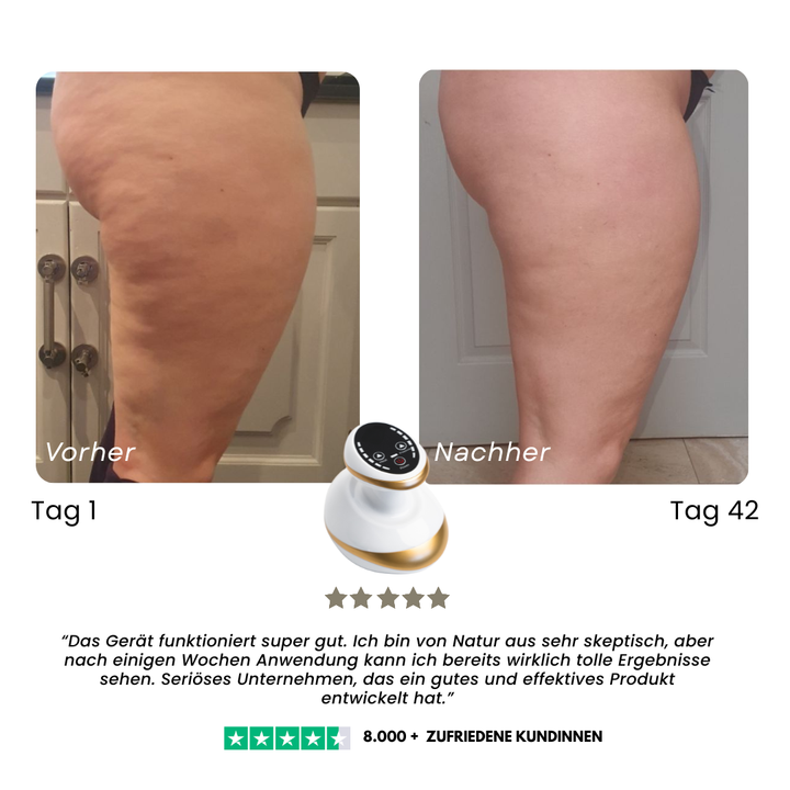Heated Body Massager | Heat &amp; Deep Kneading Vibration Massage | Smooths and Tones Thighs, Hips, Stomach and Arms