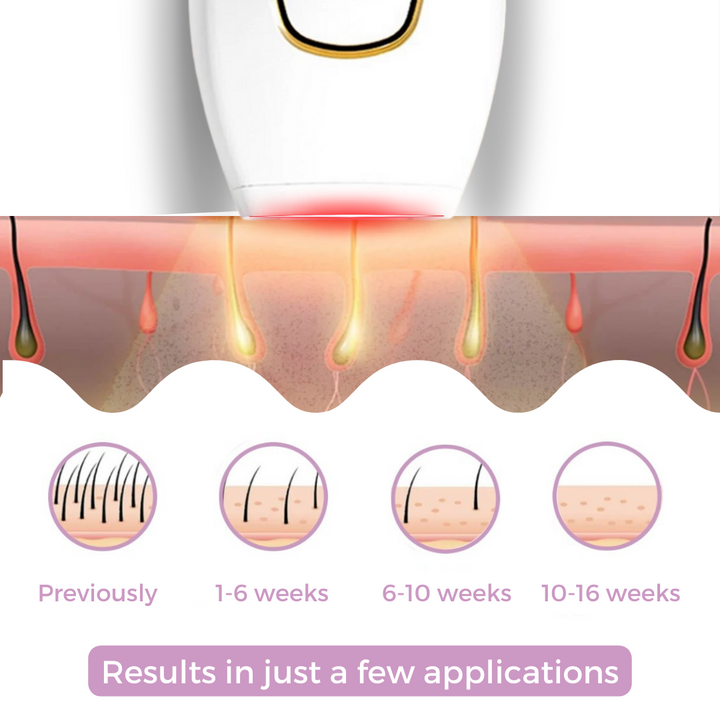 IPL Hair Removal Device | 5 Intensity Levels | Body &amp; Bikini | Home Use