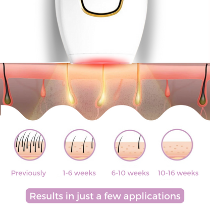 IPL Hair Remover Device | At Home Laser Hair Removal with Painless Technology | Effective Solution for Smooth Skin 6