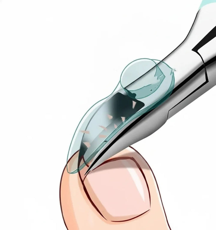 Nail Clippers for Seniors | Long Handled Toenail Nippers