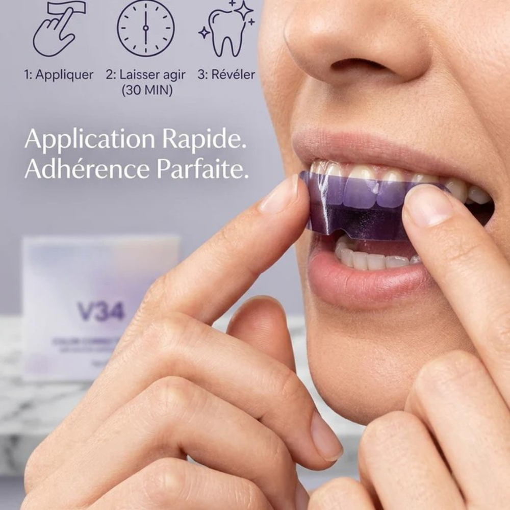 Teeth Whitening Strips | Gel Technology for Even Coverage | 30-Minute Results, Removes Stains, Gentle Formula, Easy Application