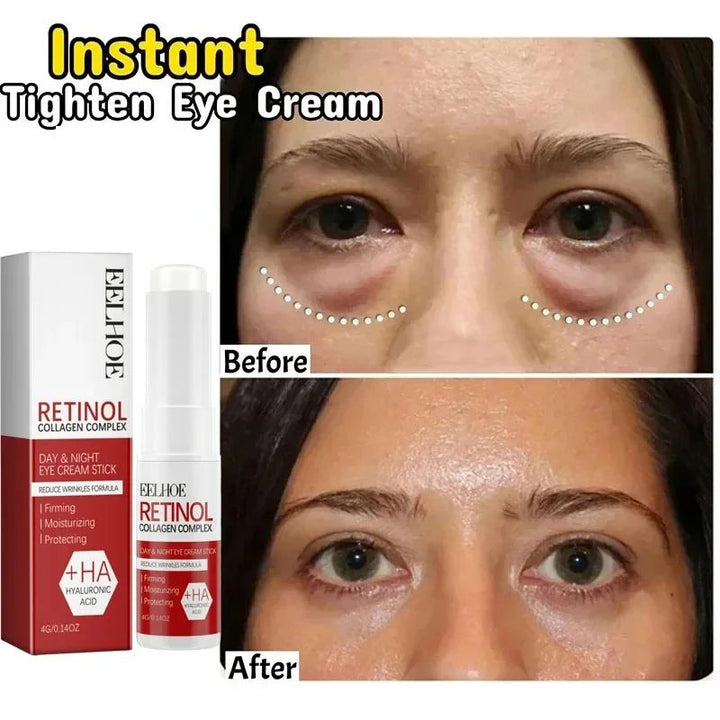 Under-Eye Cream for Women | Korean Beauty Formula | Reduces Puffiness, Dark Circles, Fine Lines and Lifts Skin