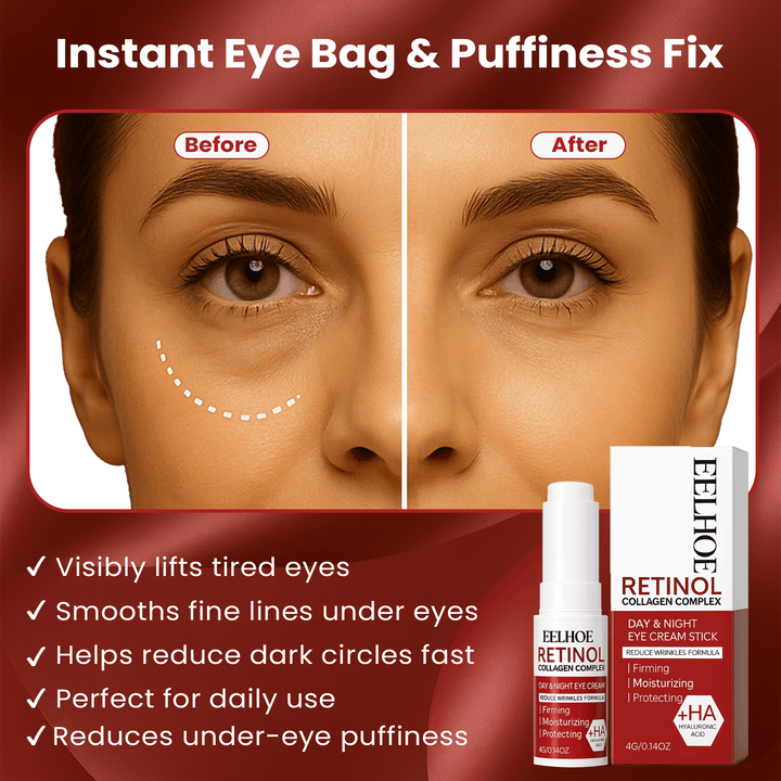 Under-Eye Cream for Women | Korean Beauty Formula | Reduces Puffiness, Dark Circles, Fine Lines and Lifts Skin