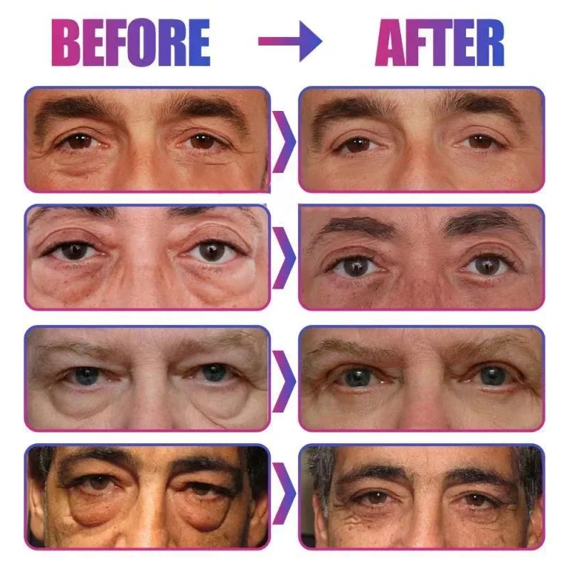 Under-Eye Cream for Women | Korean Beauty Formula | Reduces Puffiness, Dark Circles, Fine Lines and Lifts Skin