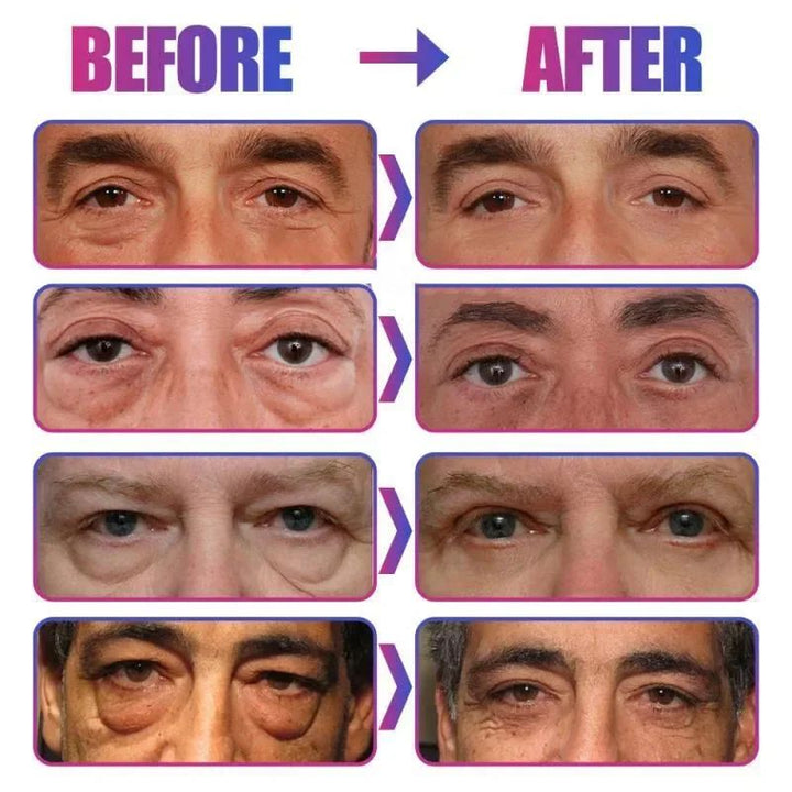 Under-Eye Cream for Women | Korean Beauty Formula | Reduces Puffiness, Dark Circles, Fine Lines and Lifts Skin