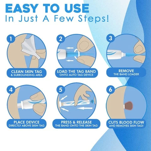 Auto Skin Tag Remover | Quick Band Application Kit