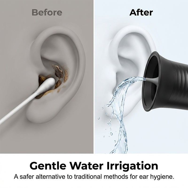 Ear Wax Removal Irrigator | Dual-Tank System with Adjustable Nozzles | Rechargeable USB-C Battery for Travel-Ready Hygiene 2