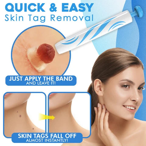 Auto Skin Tag Remover | Quick Band Application Kit