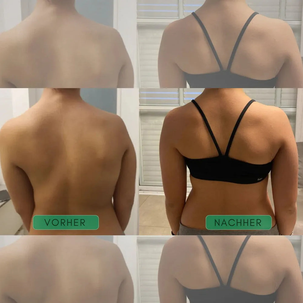 Posture Corrector Back Brace | Adjustable Straps Support Shoulders & Upper Back | Discreet Under Clothing Design 2